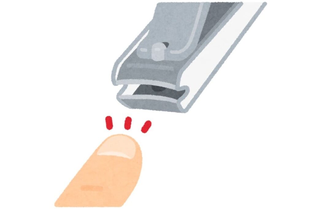 Cutting nail at night